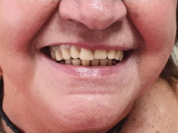 imagem-subdestaque-4_3-home-antes-1 imagem-subdestaque-4_3-home-antes-1