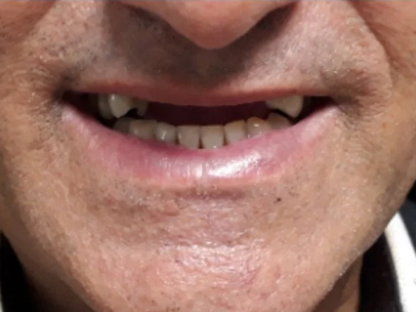 imagem-subdestaque-4_3-home-antes-2 imagem-subdestaque-4_3-home-antes-2