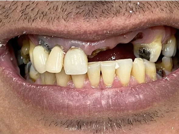 imagem-subdestaque-4_3-home-antes-3 imagem-subdestaque-4_3-home-antes-3