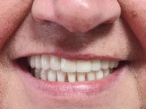 imagem-subdestaque-4_3-home-depois-1