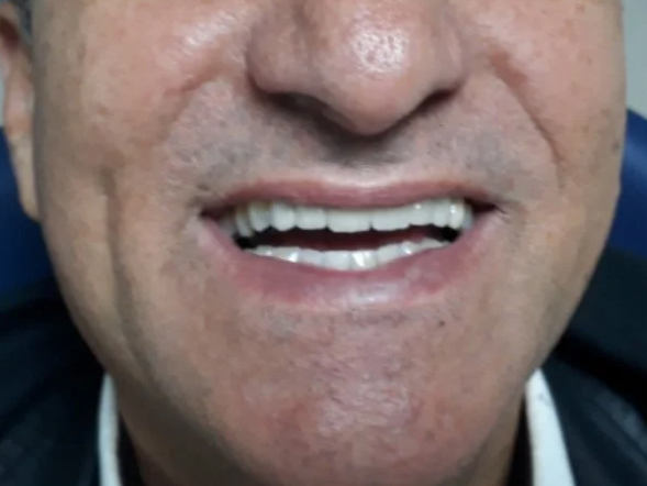 imagem-subdestaque-4_3-home-depois-2