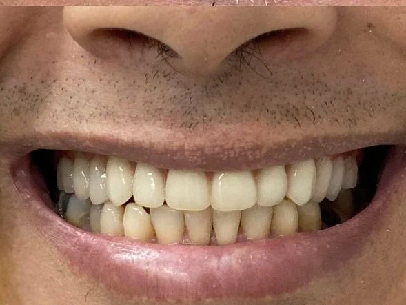 imagem-subdestaque-4_3-home-depois-3